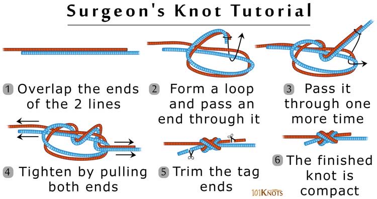 phealonfire's tweet photo. @yuewuhuansMask fabric covered elastic or surgeons knot https://t.co/V0d2f3j2RY
