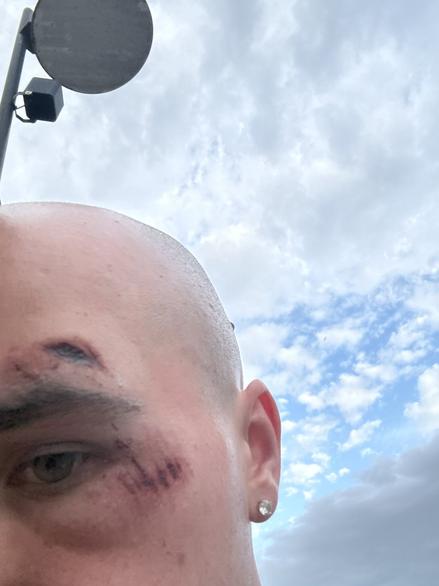 achooienn's tweet photo. This is what happens when you’re bald and talk shit https://t.co/MCOIl5pzOv