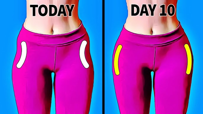 MizzyCW's tweet photo. @pelagiusreborn I've actually spent time learning about hip dips before, mostly for art, there's a large amount of women who are self conscious about their hips dips, there is an INSANE amount of videos or hacks to get rid of them "naturally" LOL https://t.co/HkZJaBcykp