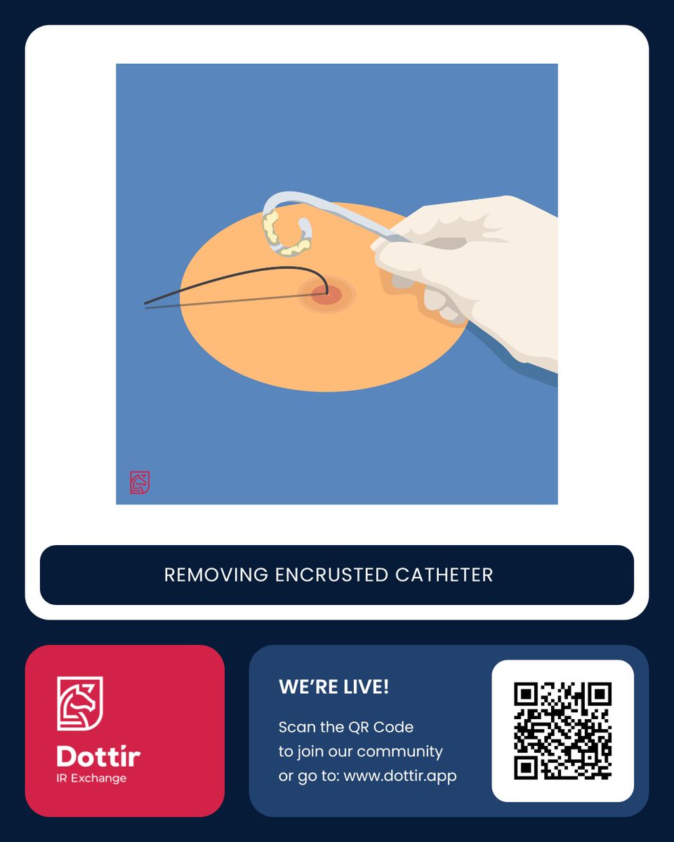 dottir_uk's tweet photo. From the patient’s signs and symptoms to the final procedure, this is the step-by-step Nephrostomy Exchange process.

Follow us across all social media for expert insights, and register at https://t.co/B6VvQA2RZm to take your IR knowledge and skills to the next level. 🚀 https://t.co/B7tN0IsZO9