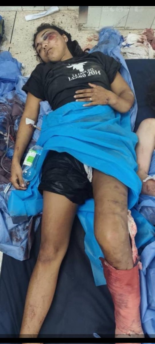 edhalem's tweet photo. @hlkaijk @GioMadinat Seguimos en las mismas, mi papá estuvo hoy en el sitio y salió bastante desalentado. Compartieron una foto pero no tengo seguridad que sea Manu pero está llenita de tierra y con golpes. Dejo la foto a ver si la logras reconocer https://t.co/Bci0OiRhmF
