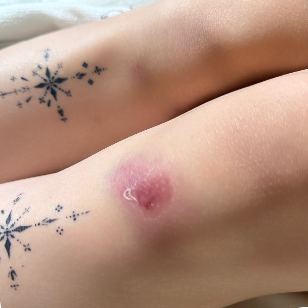 yuna_uta3's tweet photo. こいつはすごい
ほんとに姿勢も良くなるし下腹部に効く
だけど一つだけみんなに言いたいのは
絶対に急いでても走るんじゃないぞ、ということ
つま先側が分厚いから片方つまづいたらもう片方もつま先引っかかって対処不可能だから両膝から転んだ
転んだ後に走って数秒後にまた転んだ
映画館のロビーでな
ほんとに恥ずかしかった
みんな気を付けて