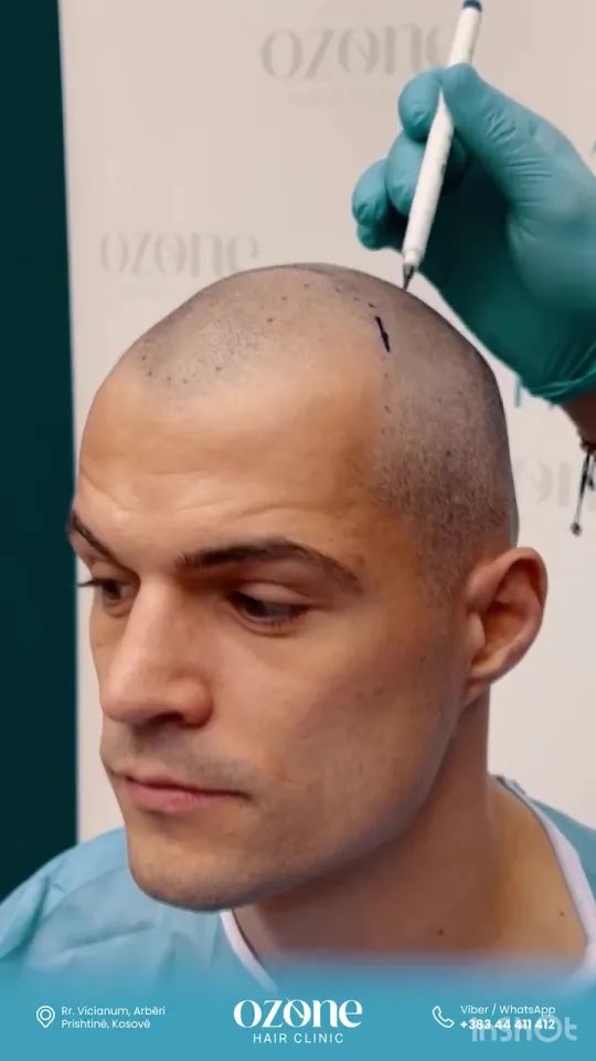 WadeSAFC's tweet photo. One has a perfect hairline 
One has loyalty 
One actually believes and backs up his own words 
One is genuine and authentically himself 
One is my real captain 

The other is Granit Xhaka. https://t.co/NvkHrjVmNP