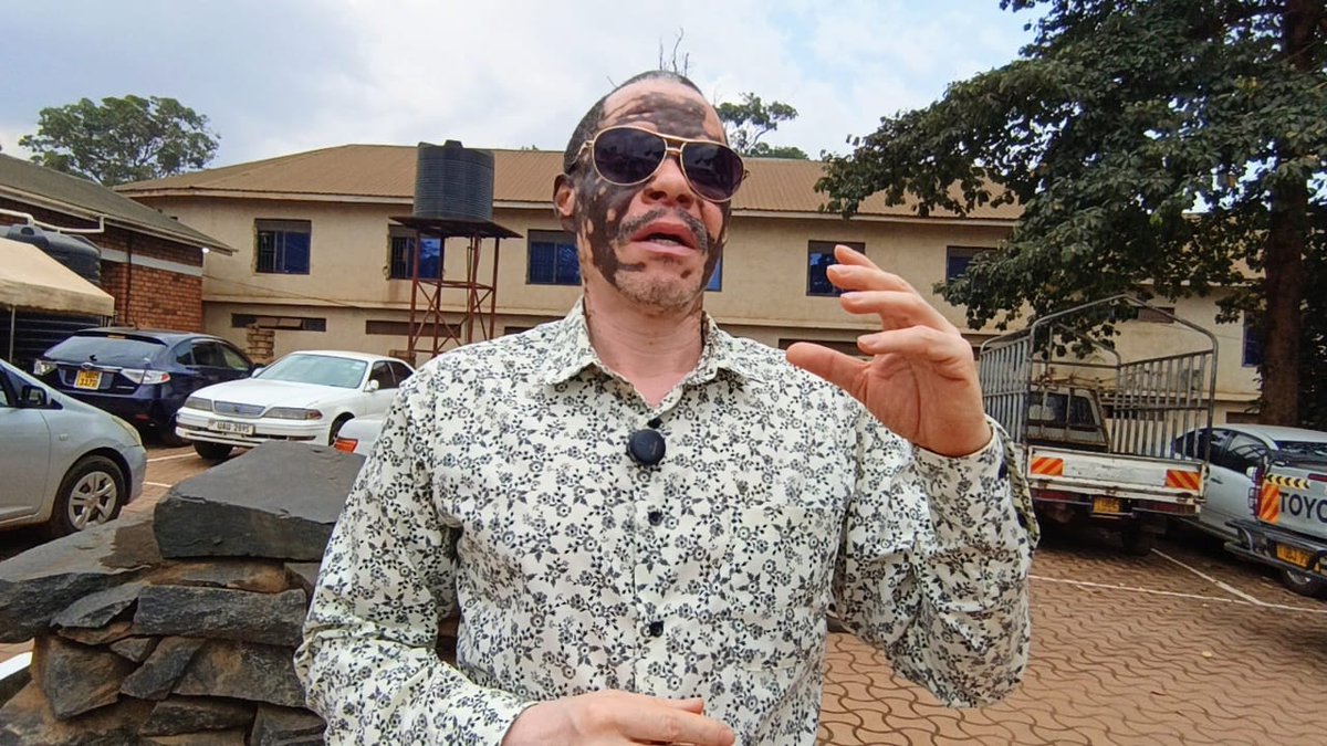 VAUorg's tweet photo. About 400 people live with vitiligo in Uganda. This is not witchcraft. It’s not contagious. It’s a medical condition caused when melanin-producing cells stop working. Stress, genetics, and medication misuse can trigger it.
Early treatment helps. Self-medicating makes it worse. https://t.co/eitspAA9ae