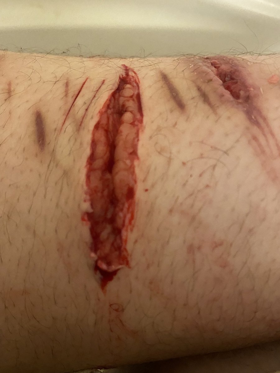 AugustKody's tweet photo. this might be my last cut for a while 💔 https://t.co/qVF5J8mU86