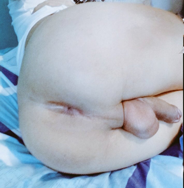 Estrogenpndj0's tweet photo. 💗🐽Pregunta sería, mis amores 💢🐽

¿¿Si a este pndejo estrogenado, se le ocurre poner su 📷cola📹 en venta, lo apoyarían patrocinandolo??💢🐽

"Si"=🔄

"NO PNDEJO qLO GORDO, AHORA VAMOS A F0LL4R CÓMO CERDOS"= ♥️+🗨️ https://t.co/OGS2hz4N6Q