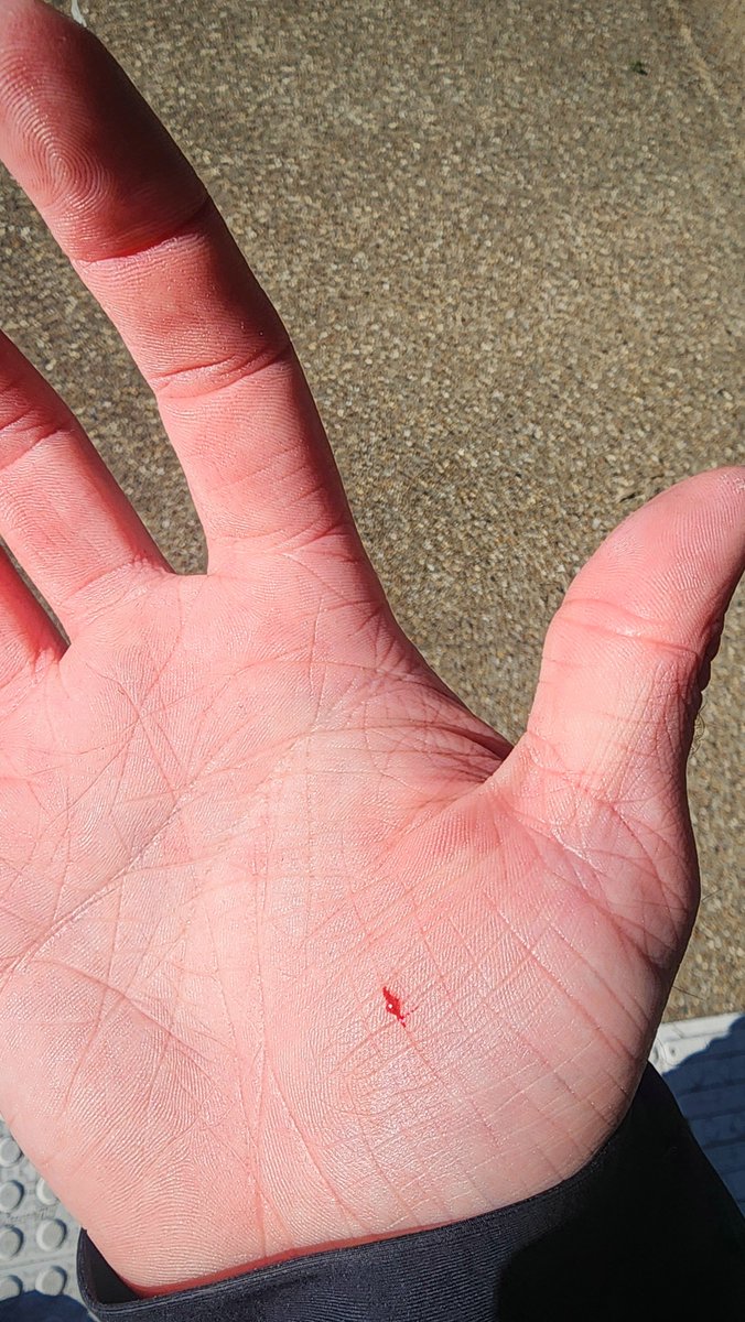 conversacean's tweet photo. Just cut myself on the exterior of a Nalgene bottle... I have absolutely no idea how that is even possible https://t.co/y5whkMDZpP