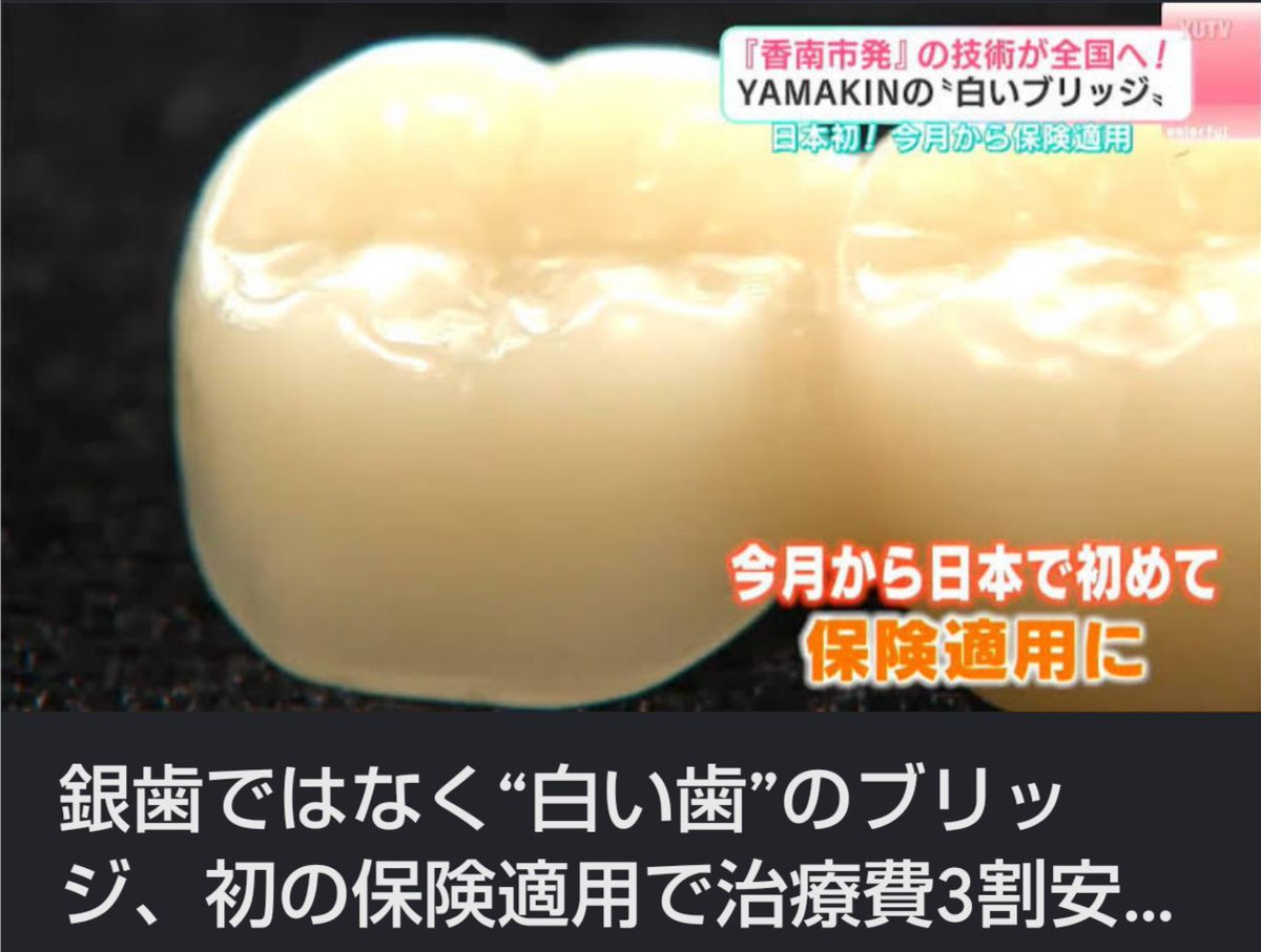 Ho_iori_hoihoi's tweet photo. 銀歯って結構前に
禁止じゃなかったっけ？

超対応遅くない？

※体に毒な金属

提供元: Yahoo!ニュース
 https://t.co/tQ8pInFcKo https://t.co/QXm0oglmJT