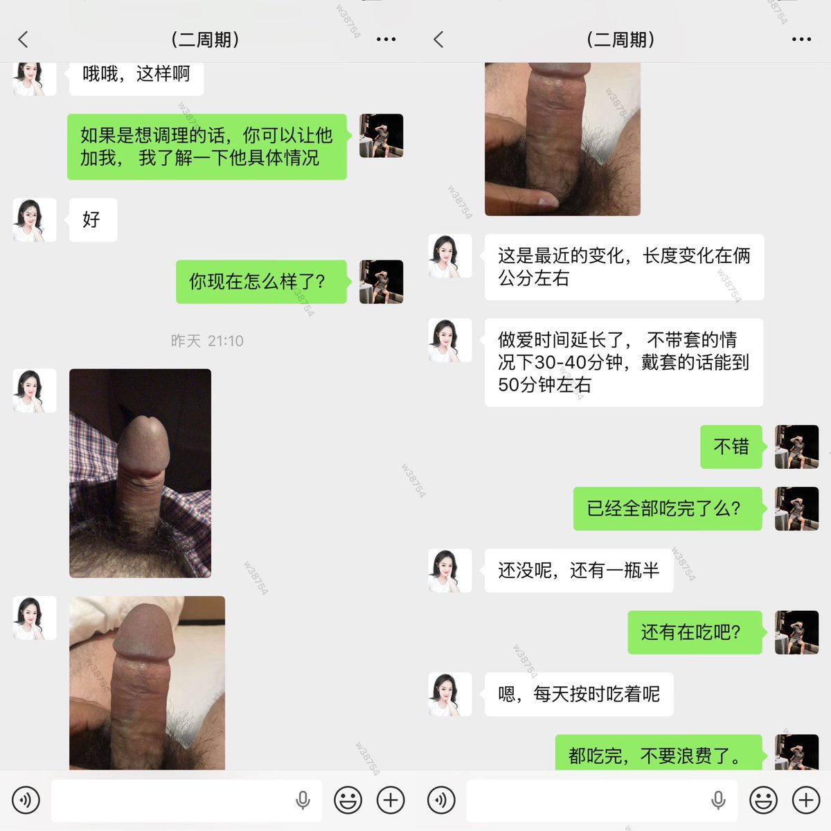 vxw38754's tweet photo. 🔥🔥🔥嘴上说好的是套路，身体说好才是王道。每一张反馈截图，都是盖在我们脸上的“优”字章。认可，就是最好的质检报告！！！
咨询改善微信：w38754
#阳痿 #早泄 #滋阴补肾  #龟头敏感 #延时 
#手淫过度 #硬度 #针对男性问题18到65周岁 https://t.co/VOE69TF8Wa