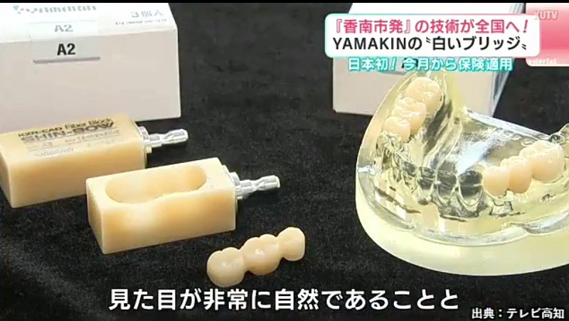 moeruasia01's tweet photo. 【凄】高知の歯科材料メーカーが開発した樹脂製『白い歯のブリッジ』が保険適用に　貴金属（銀歯）より３割安く

歯のスキャンデータからCAD/CAM精密加工
→ 技工効率化を実現

「歯」部分のブリッジ中心にグラスファイバーの芯
頑丈で壊れにくい
金属製よりも加工しやすい
精度が高い https://t.co/uYHDfEfbmC