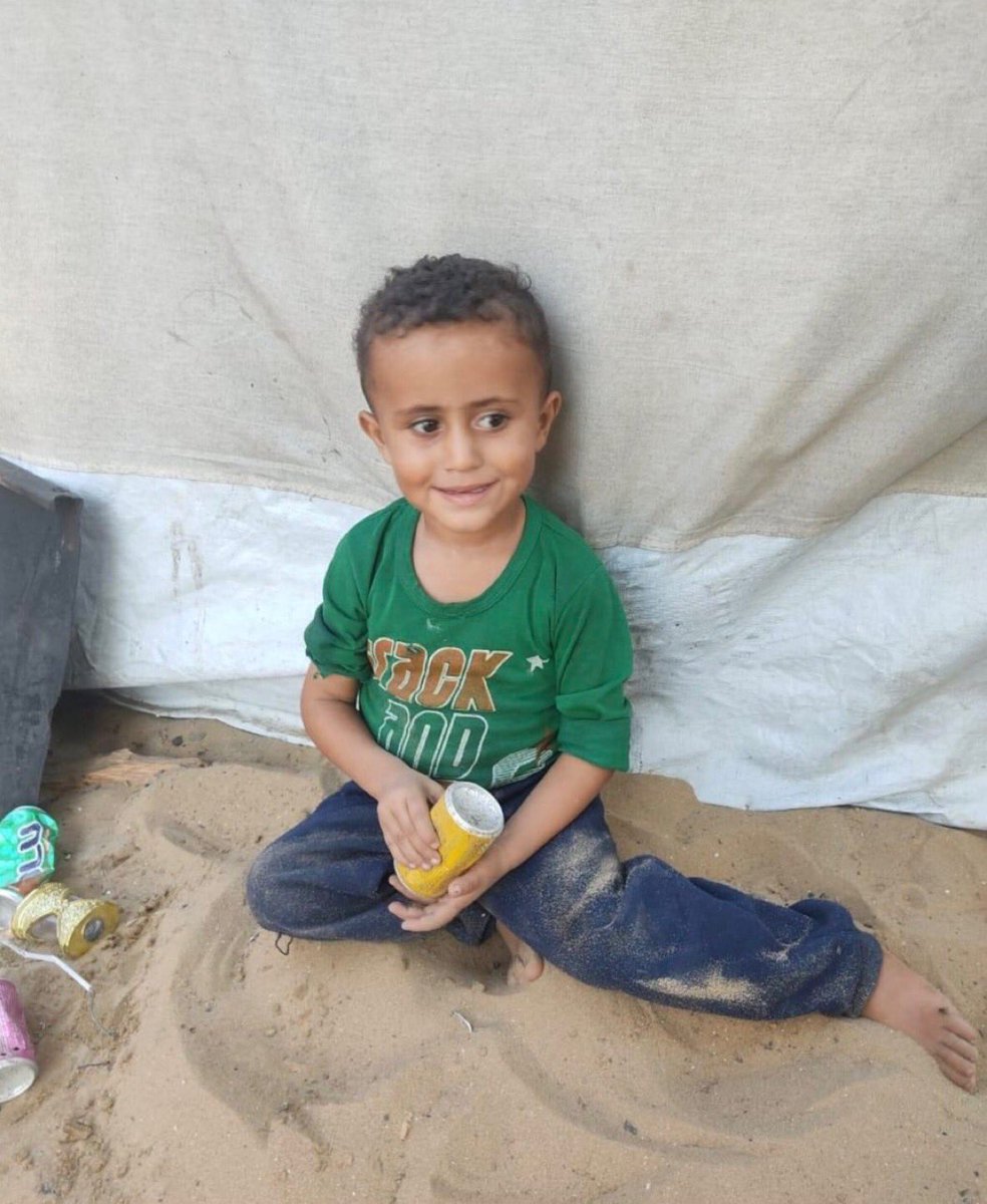 Tvlman's tweet photo. Trump is still starving children! He killed USAid and now it’s killing these children. https://t.co/yG3VQCFSX4