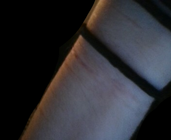 HarmingSeb's tweet photo. arm scars, couldn't take good photos because im using my computer to take photos currently. sorry if u cant see them. #shedtwt #shtwt #988twt #shtwt #slittwt https://t.co/RQfy5kzoWo