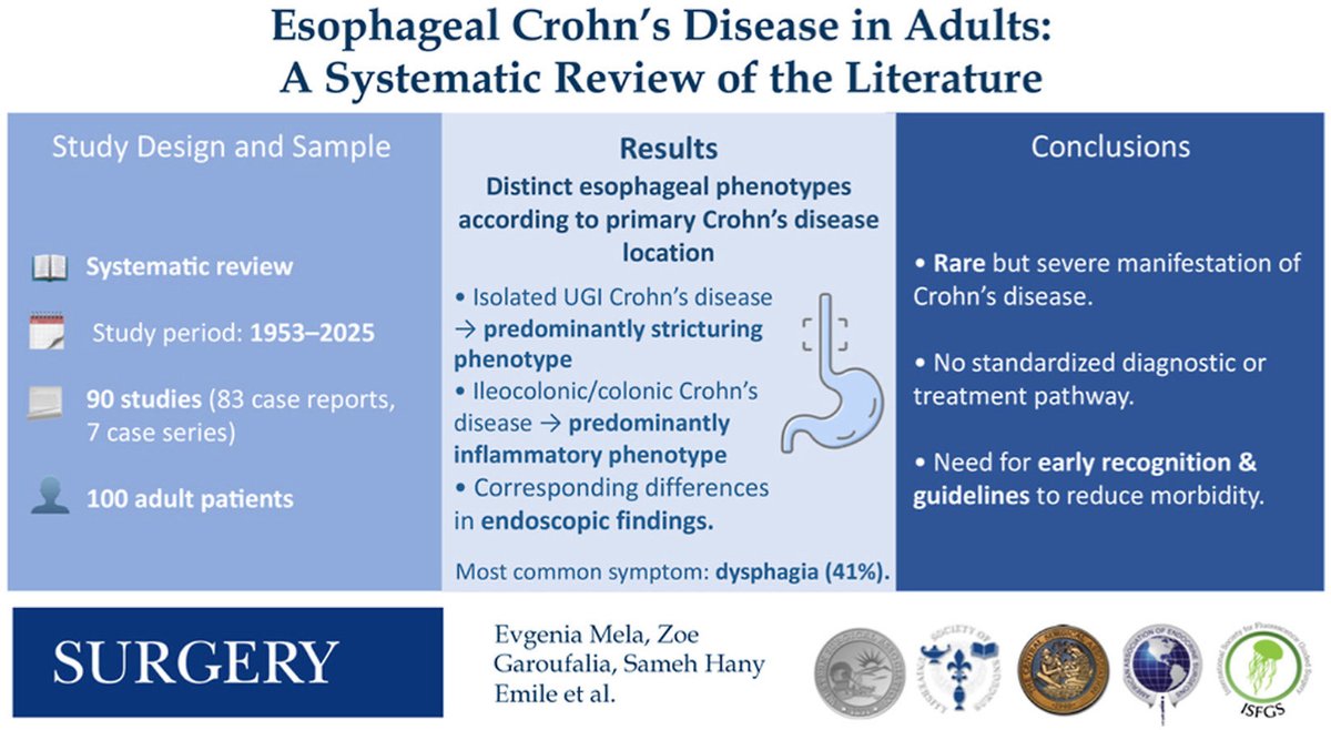 SurgJournal's tweet photo. Εsophageal Crohn's disease in adults: A systematic review of the literature

https://t.co/EHqpuc7Lgu

@ZGaroufalia @dr_samehhany81 

@SWexner @CaitlinWHicks @juliomayol @debby_keller @SyedAAhmad5 @TomVargheseJr @luciacolorectal @A160186 @GaertnerWB 

#SoMe4Surgery https://t.co/WYQ1qIdNvu