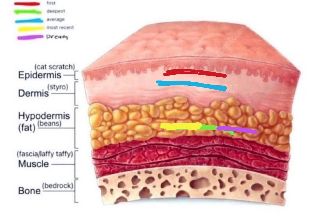 literallyuzi__'s tweet photo. Updated version...
Accidently hit an artery.
#shtwt #shedtwt #beanstwt #fasciatwt #selfharm #988twt #slittwt https://t.co/vWc0LBGYOI