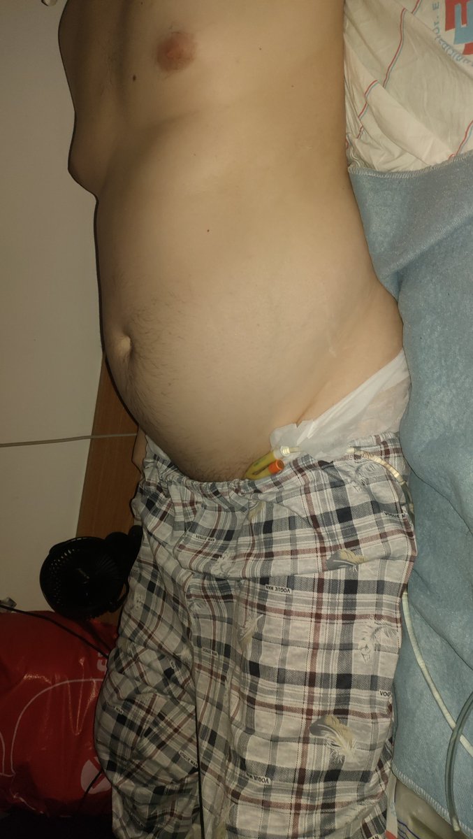 Paralyzedguy33's tweet photo. https://t.co/0w1ciazKAh