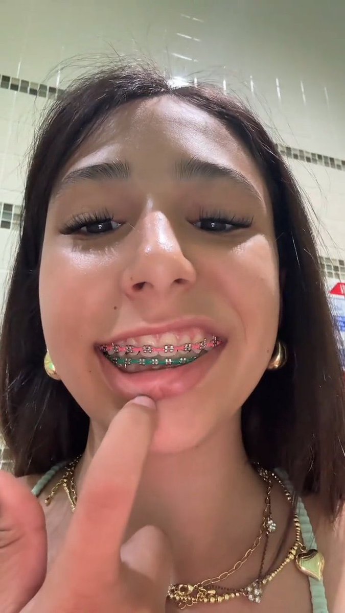 goddessgoonfuel's tweet photo. Wake up and start stroking to your bop Goddess Ivy Jones. You sick perverts love getting filthy when you see braces. You cant help but get hard. All you want is to leak for tik tok porn facss 😵‍💫💖💦 https://t.co/3oWJoCdgyE