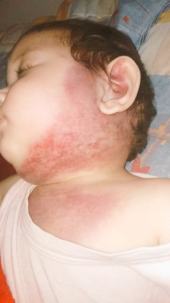 FadiQGaza's tweet photo. Unfortunately, no one cares 😭

︎
︎

︎

︎

︎

︎
︎

︎

︎
︎

we’ll remind you
︎

︎

︎

︎

︎
︎

︎

︎

︎

︎
︎

︎
︎

︎
︎

︎

︎

︎
︎

︎
that
︎

︎

︎

︎

︎

︎
︎

︎

︎

︎

I desperately need TREATMENT for my baby😭 

https://t.co/JfHbTibqCl https://t.co/bm8wTz4GJy