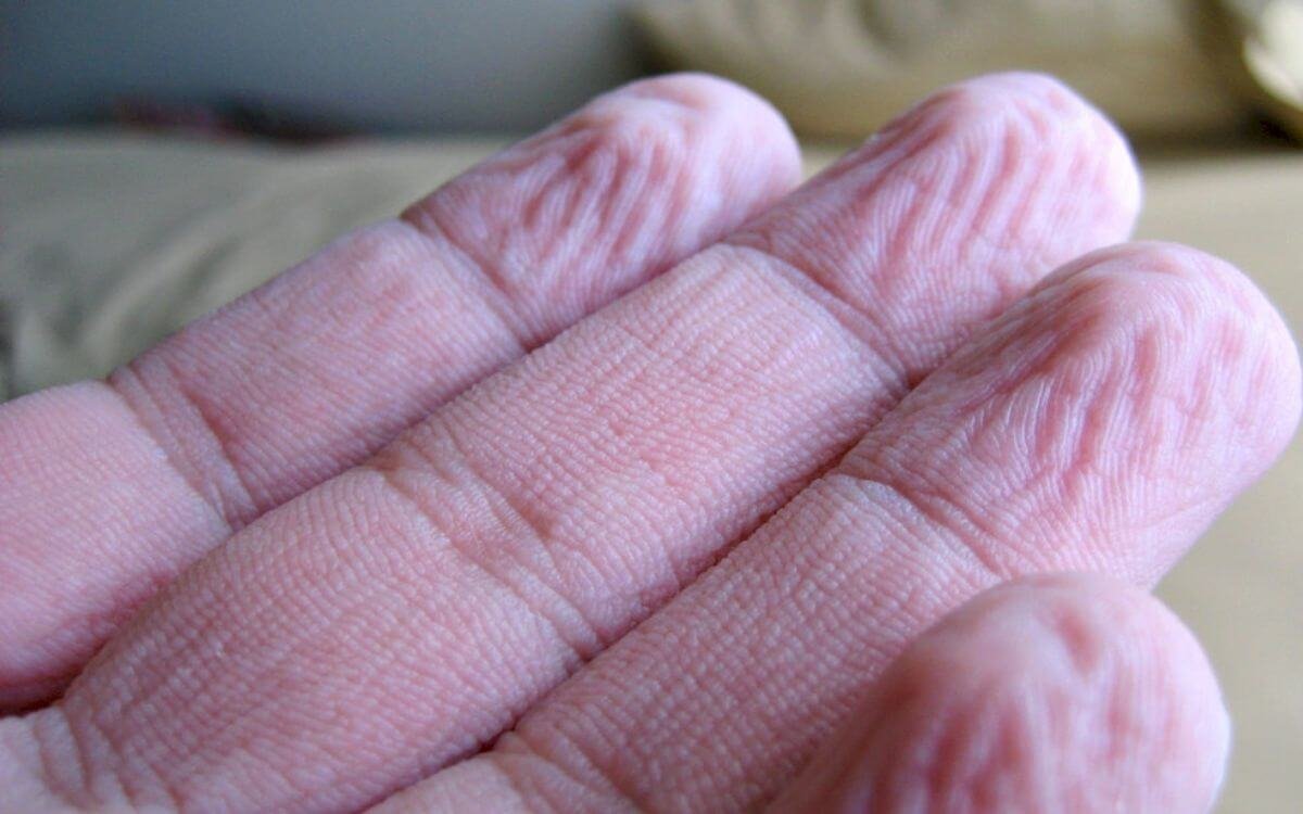 NalinisKitchen's tweet photo. When your fingers stay in water for 5 to 30 minutes, they become wrinkly. It's not because your skin absorbs too much water. Your body does it on purpose.

- Water slightly swells the outer layer of your skin
- Triggering your nervous system to narrow the tiny blood vessels in your fingertips.
- As the tissue underneath shrinks, the outer skin folds into wrinkles.

Scientists believe these wrinkles improve your grip on wet objects. Fingers and toes wrinkle because they're used for gripping and walking, unlike most other body parts.