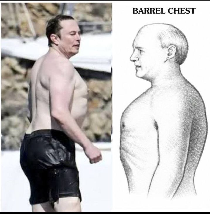 Ruthhaslanded's tweet photo. How real is this picture, @grok? Though Elon Musk's barrel chest. It's kinda cute. https://t.co/hwDPfOViLa