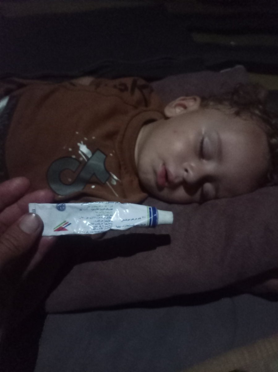 nsgosama's tweet photo. You can imagine how harsh the summer allergies and itching are,but imagine facing them after I run out of medication for my baby.Ican't continue to treat him,and only a few dollars are enough to replace the treatment.Any support or participation will mean a lot to me &amp; my child https://t.co/TnMnn2R4XB