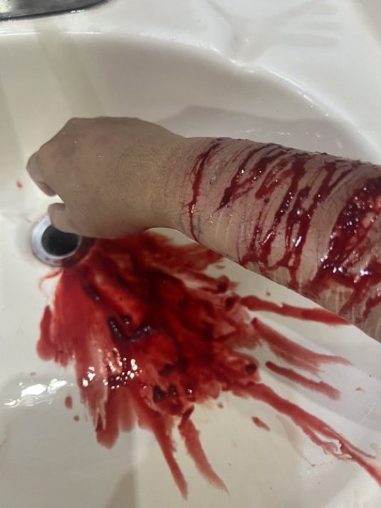cigsl0ver's tweet photo. #sh #shtwt #gore #slittwt #988twt https://t.co/MX0FRXzYiv https://t.co/mj829BxTGy