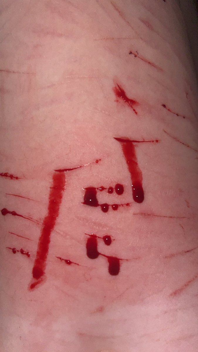 kadief7lp's tweet photo. SFX FAKE MAKEUP
a few from earlier 
#shtwt #shedtwt #shedrtwt #edtwt #slittwt https://t.co/IEzSzMY3qE