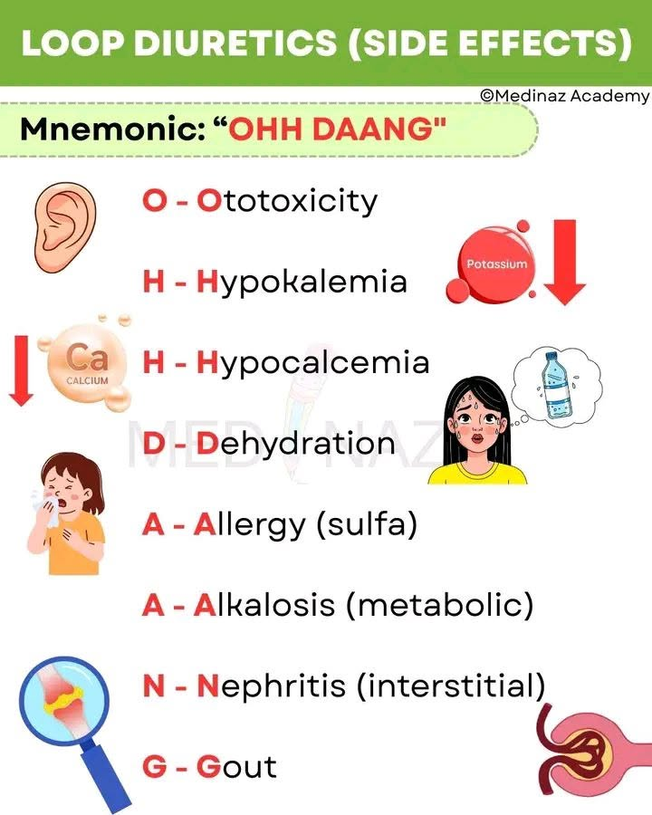 AB_drmd's tweet photo. ✅المريض هذا لما جاء بـ Decompensated Heart Failure عطوه في الطوارئ loop diuretics ومنها Furosemide عشان يتخلص من الماء الزايد اللي تراكم في جسمه، وهنا تبدأ القصة. 

الـ loop diuretics تشتغل على الـ thick ascending limb في الـ Loop of Henle داخل الكلية وتوقف امتصاص الصوديوم والكلور والماء، بس المشكلة إن الكلية عندها transporter اسمه URAT1 مسؤول عن إخراج الـ Uric acid في البول، لما تيجي الـ loop diuretics وتخلي الجسم يفقد كميات كبيرة من السوايل يصير عندنا شيئين يضربون المريض مع بعض، الأول إن الدم يتركز وتقل كمية السوايل فيصير عندنا Volume depletion وهذا يحفز الكلية ترجع تمتص كل شي زيادة بما فيها الـ Uric acid بدل ما تطرده، والثاني إن الـ Uric acid نفسه يصير يتنافس مع الـ diuretic على نفس الـ transporter في الكلية ف يفوز الـ diuretic ويطلع بره والـ Uric acid يفضل محبوس في الدم، النتيجة إن مستوى الـ Uric acid في الدم يرتفع وهذي الحالة نسميها Hyperuricemia، ولما يرتفع الـ Uric acid فوق طاقة الدم على إذابته يبدأ يترسب على شكل بلورات اسمها Monosodium Urate Crystals وهذي البلورات تحب تتجمع في أبرد مكان في الجسم وأبعده عن القلب وهو مفصل إصبع القدم الكبير اللي نسميه الـ First Metatarsophalangeal Joint، لما تتجمع البلورات هناك جهاز المناعة ما يتركها، الـ Neutrophils تحس فيها كأنها جسم غريب فتهجم عليها وتحاول تاكلها بالـ Phagocytosis، لكن البلورات هذي قاسية وتخرش الـ Neutrophil من الداخل فتتفجر وتطلق كل المواد الالتهابية تاعتها زي الـ IL-1 والـ TNF وهذا يسبب التهاب حاد مفاجئ في المفصل يصحى منه المريض من النوم ويلاقي إصبعه أحمر منتفخ ساخن كأنه اشتعل نار، وهذي هي الـ Acute Gouty Arthritis.

عشان كذا المريض اللي يجي بـ Heart Failure ويعطونه loop diuretics لازم الطاقم الطبي ينتبه لمستوى الـ Uric acid عنده ويحذره إنه قد يحس بعد أيام بألم في إصبع قدمه وما هو شي جديد بل هو side effect معروف للعلاج.