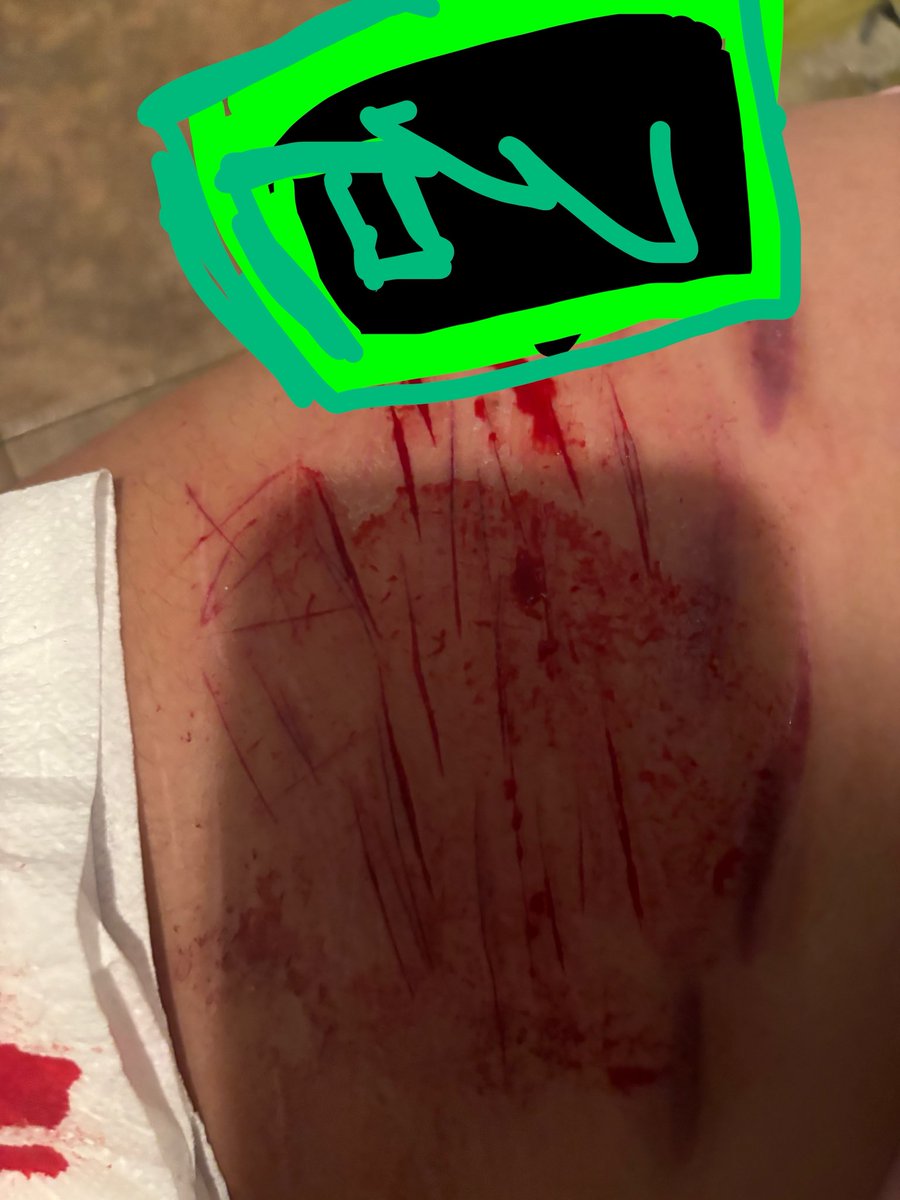 Veelover_69's tweet photo. Uh yeah O cut today BC I was bored and BC I'm so BORED I'm gonna do more. https://t.co/nyWPsgBwlF