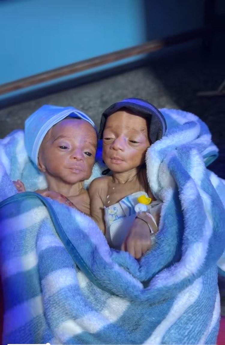 WiszAyo's tweet photo. Congrats to aunty ramota she just put to bed and gave birth to twins the resemblance is crazy 🥹 https://t.co/ymzMdWds5g