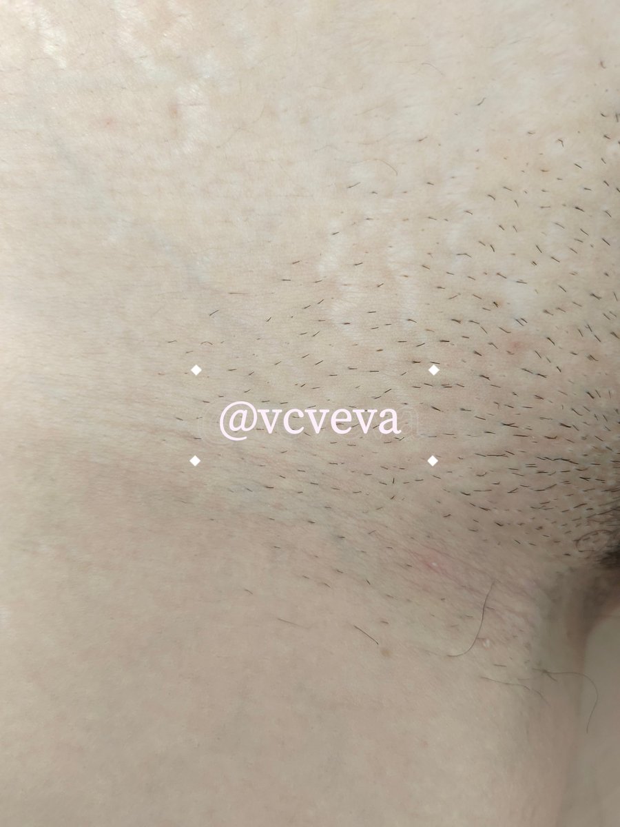 vcveva's tweet photo. 貌似翻车了，怎样才能像白虎那样白静光滑 https://t.co/Vxd0k5uxLN