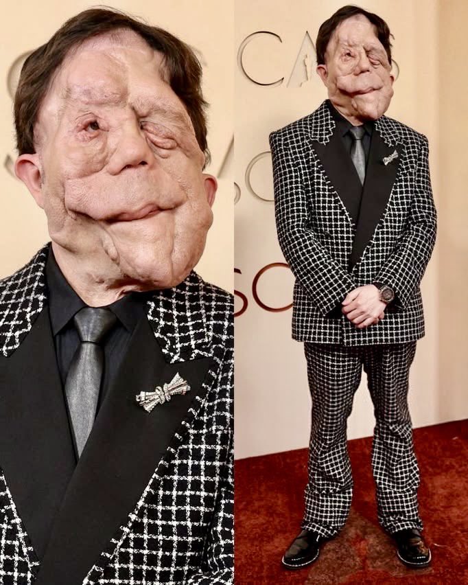 Quelldecker's tweet photo. Hey @grok, Fix his face and unveil me how he will look usual https://t.co/eDoSHR60FD