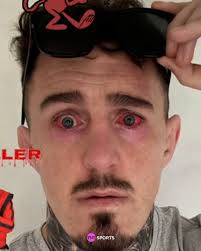 Goatedrubert's tweet photo. @RyanTmYt also just need to put this out there since morons seriously think aspinall is faking it https://t.co/rTU9bHaUdw