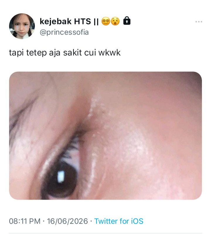 𝒦. tweet media