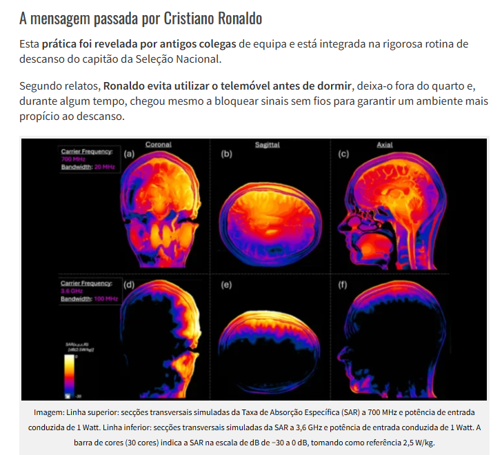 75Alcaide's tweet photo. 🚨A MENSAGEM DE #CR7 VS A NARRATIVA HIPÓCRITA DA IMPRENSA.💥
🩻 A PROVA VISUAL. COMO O CÉREBRO ABSORVE O #5G E AS RADIAÇÕES #EMF.🧠🛜🤕
🙄A Normalização e a Hipocrisia da Imprensa.
A imprensa recorre aos habituais "especialistas" para questionar ou atenuar a eficácia da medida. Há que defender a indústria e os patrocínios, mas a verdade prática é assumida pelo maior atleta do mundo.
☣️A imagem científica incluída na notícia da PPLWare detalha os mapas de Taxa de Absorção Específica (SAR) e expõe o impacto real de 1 Watt de potência no tecido cerebral, comparando frequências de 700 MHz e 3,6 GHz.
🧐A autópsia da imagem médica:
🧠700 MHz (Linha Superior):
Comprimento de onda maior que penetra profundamente até ao centro da massa encefálica.
🧠3,6 GHz (Linha Inferior):
Micro-ondas de alta frequência que concentram a energia na periferia, córtex e crânio.
📶🇵🇹Em #Portugal já há quem opere em 26 Ghz, agora pensem.
🧪🧬 Esta deposição de energia é o stresse oxidativo silencioso que o próprio Parlamento Europeu (EPRS) citou no relatório "Effects of 5G wireless communication on human health".
📵Ao desligar o Wi-Fi e afastar o telemóvel, Cristiano Ronaldo impede que os seus tecidos absorvam este bombardeamento térmico durante o sono.
👍Estudem a física e SIGAM O EXEMPLO DE UM ÍCONE MUNDIAL.
💰Não é preciso ser milionário como o ©️®️7⃣, para aprender a desligar o WIFI e o #5G e ter mais saúde, mas essa escolha pode poupar-vos muitos milhares de euros em problemas de saúde.
⚠️Acordem. E afastem as crianças destas radiações super nocivas. Protejam as crianças.
Têm essa obrigação.
#Biofisica #Saude #IMT2030 #IEEE #EMF #RNI #WIRELESS #WIFI #STOP5G