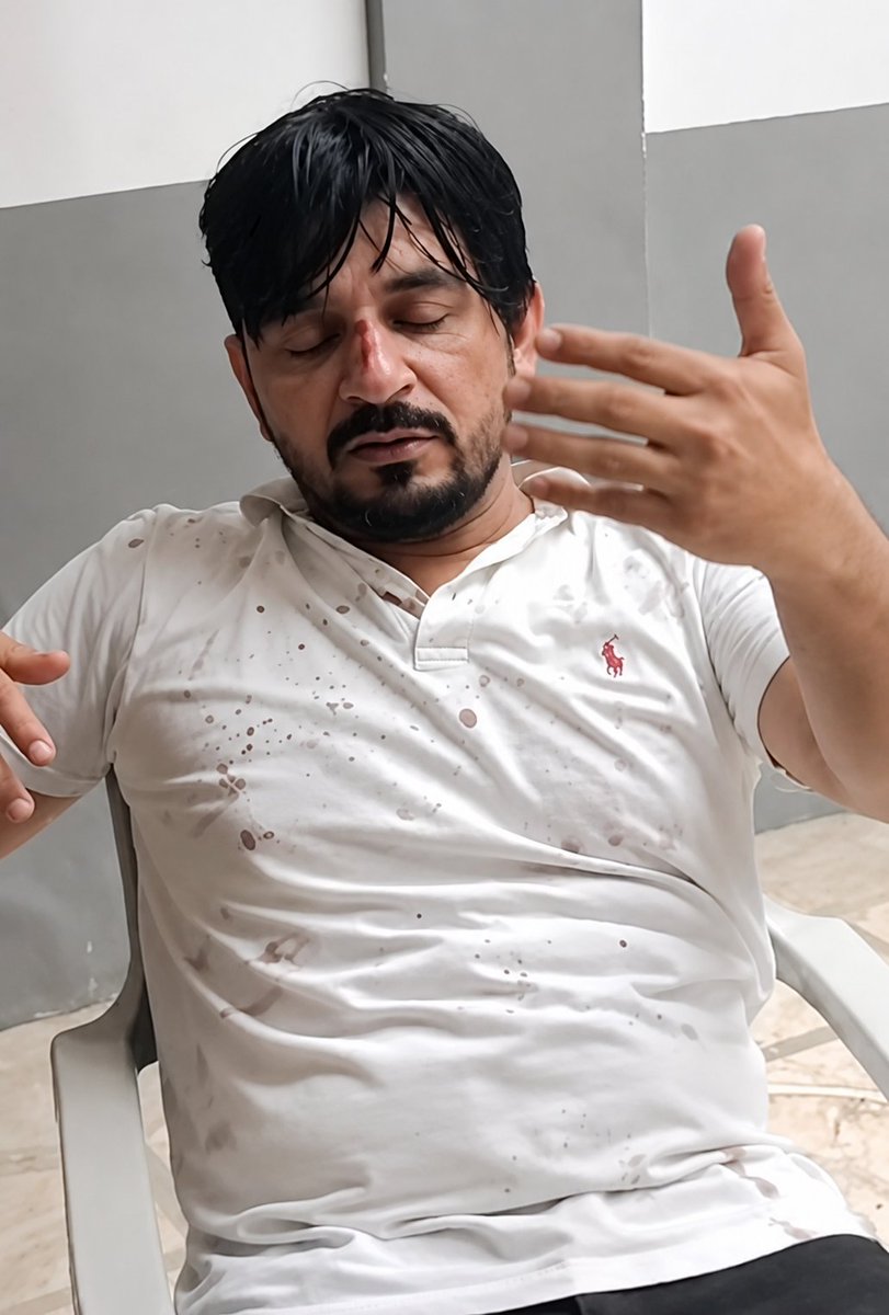PirzadaWeb3's tweet photo. Another short-term kidnapping reported in Gulshan-e-Iqbal, Karachi, Pakistan.

Another same story, He wasn't hacked or scammed, 

The victim was allegedly abducted and forced to transfer his crypto.

The person JS Rao, a popular crypto influencer whose community recently saw one of the highest trading volumes on Binance in South Asia.

According to the report, he was driving when a van suddenly blocked his car. 

Four armed men got out. He tried to escape, and shots were even fired at him, but he survived.

They then forced him into their van, blindfolded him, and took him to a house where he was brutally beaten with baseball bats. 

His nose and hand were broken. 

He was allegedly forced to provide fingerprint access, close all open crypto positions, and transfer around $500K–$600K.

They also reportedly took control of his 
→ bank accounts
→ crypto wallets
→ phone
→ contacts

and everything else before dumping him at an unknown location a few hours later

First it was Arsalan malik, then Manzi crypto, then one more guy and now Him, this same story keeps repeating and it seems like Pakistani government is just making policy to add taxes on crypto but no safety for people

Hey @Bilalbinsaqib is there anything you guys are going to do for the safety of people who works in decentralized world?