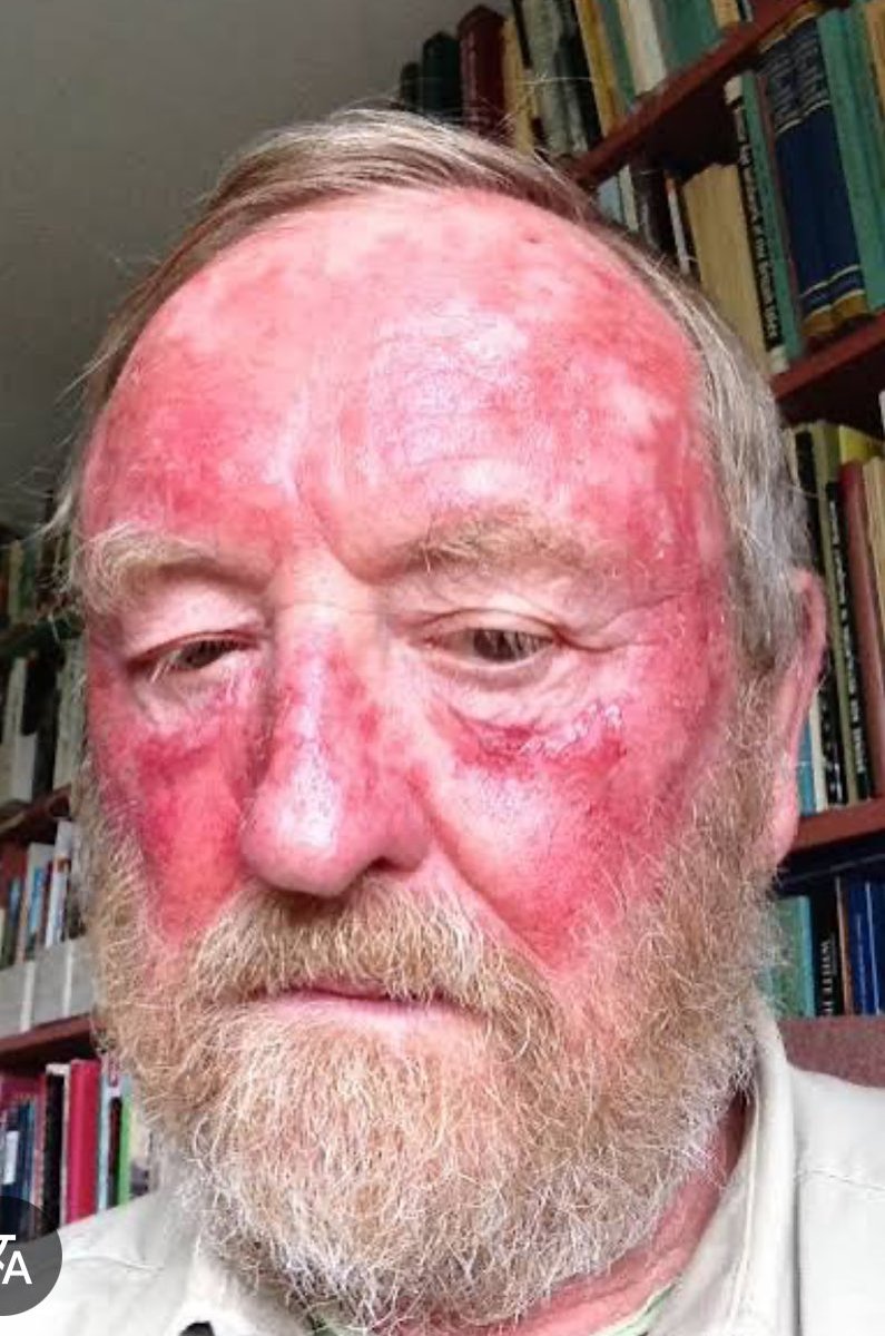 that2003show's tweet photo. @EsBigred @Matt55399956126 @bigbabolat No bro dats not how evolution works but yes im not a child yea u do get more vitamins from the sun but lowkey what does dat do for you logistically  cause the reason u absorb more vitamin,  makes the risk of cancer lower &amp; TRIVE IN EVERY CLIMATE? lol https://t.co/v32YCYbXpo