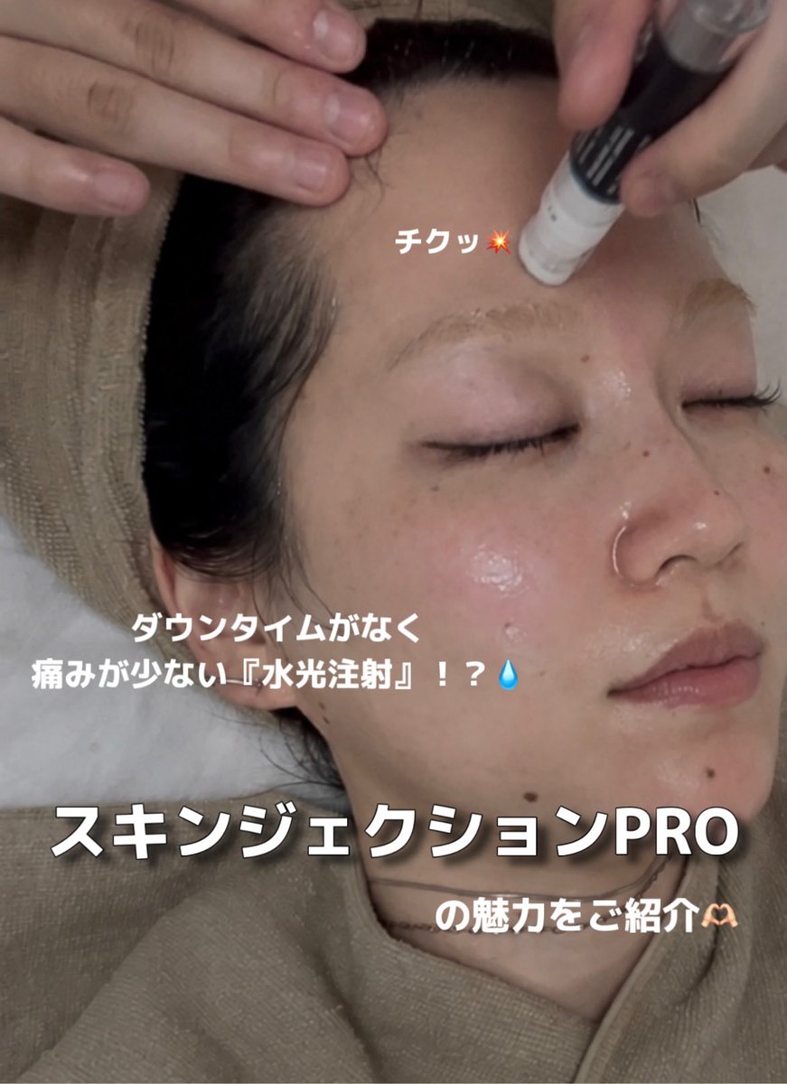 UneLimit39's tweet photo. こんにちは♪
unelimit原宿店みづきです☺︎

大人気施術『スキンジェクションPRO』✨
お肌に水分を与えながら肌再生を促してくれるメニューです。
入れ込む美容液はアンプルによって効果が違うので、肌質やお悩みに合わせて3種類から選べます❗️
#原宿 #原宿竹下通り #フェイシャル #肌質改善 #水光注射 #エイジングケア #保湿 #鎮静