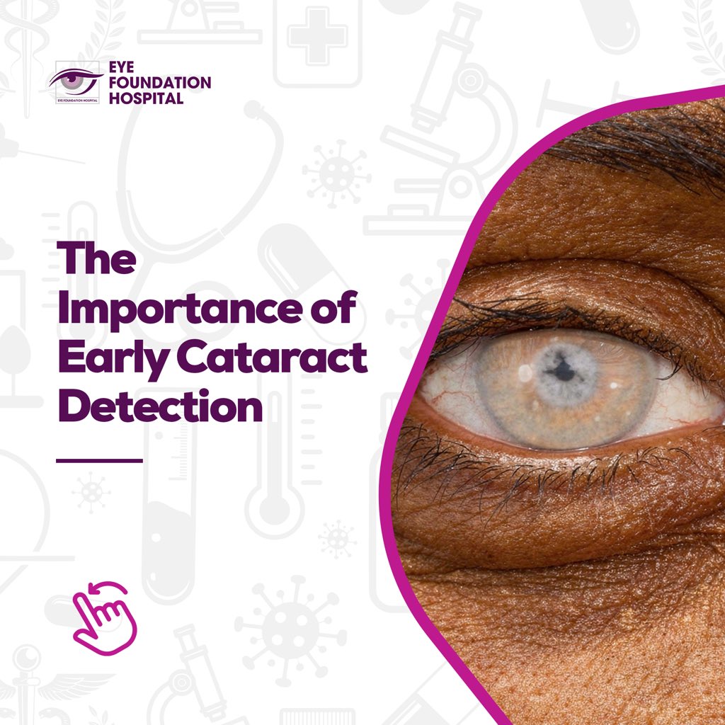 eyefoundationng's tweet photo. Cataracts often develop gradually, making it easy to miss the early warning signs until vision becomes seriously affected. That's why early detection is so important. https://t.co/FazSEQWWER