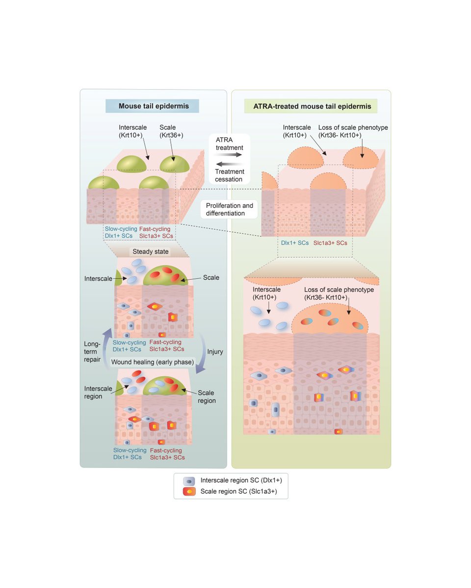 theJIDJournal's tweet photo. See Kosumi et al's Commentary:
Retinoic acids shift skin stem cell fate
https://t.co/kUFBOjyGDe
Retinoic Acid Signaling Alters the Balance of Epidermal Stem Cell Populations in the Skin
https://t.co/ltVOUOG4pj
#dermtwitter #dermatology #dermscience #dermresearch https://t.co/GQA0xma18N