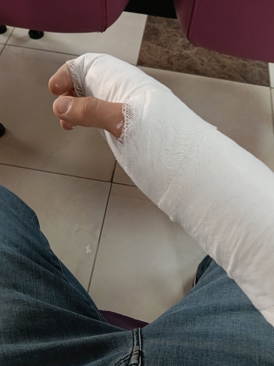 LouBloom61's tweet photo. kolu çatlattık :( https://t.co/uV3REge0ya