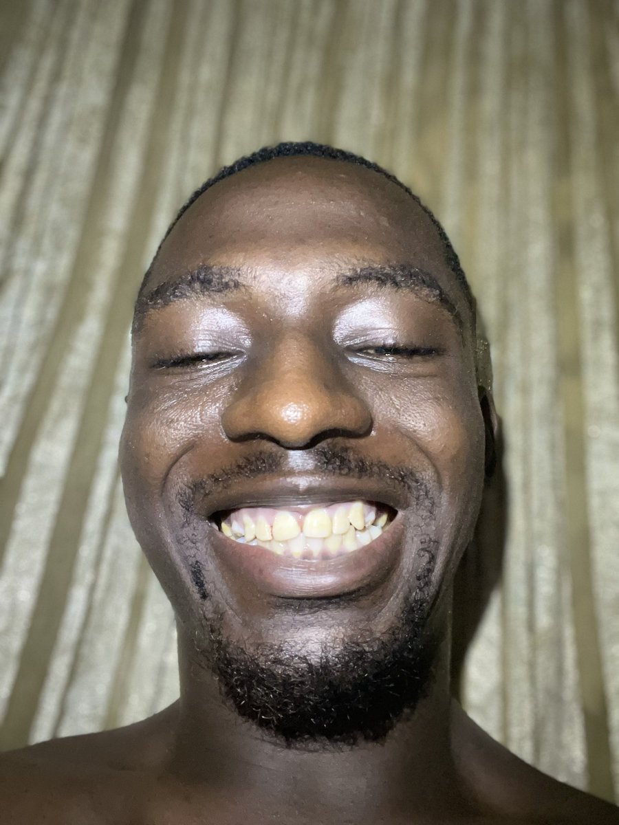 Smarthkid_'s tweet photo. See as my teeth white https://t.co/xEpikuHbUr