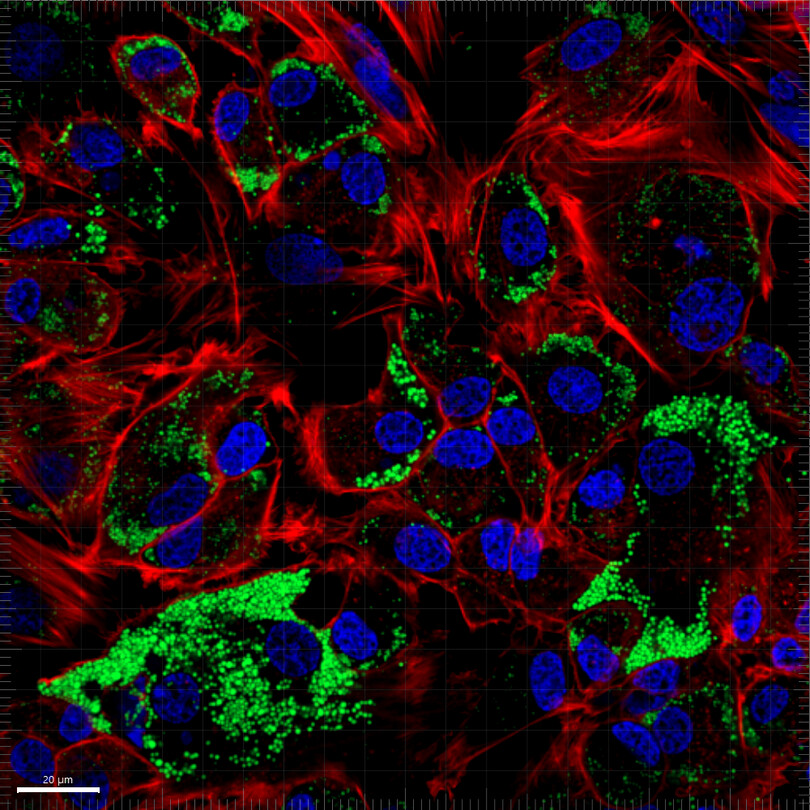 EwelinaBolcunF's tweet photo. #ReproBioArt Where science becomes art!  Dive into the hidden beauty of reproductive biology. Take a closer look at this granulosa cell hard at work and explore the full collection in the gallery.  🔬 https://t.co/DYAE1Adhh8 https://t.co/46svGVUn56