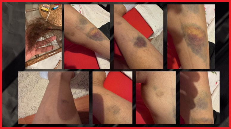 AKP'li MKYK Üyesi Ömer Faruk Besli, Aldatma ve Şiddet İddiaları Üzerine İstifa Etti