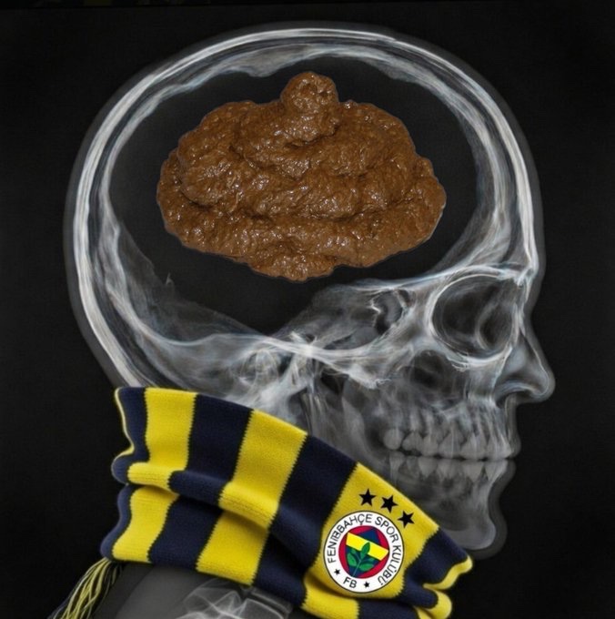 RErol64's tweet photo. @FB4406FB Beyin olmayınca olmuyor, kafayı iyice Galatasaray ile bozdunuz,ne diyelim ,acil şifalar dilerim https://t.co/P7myd1mDCO