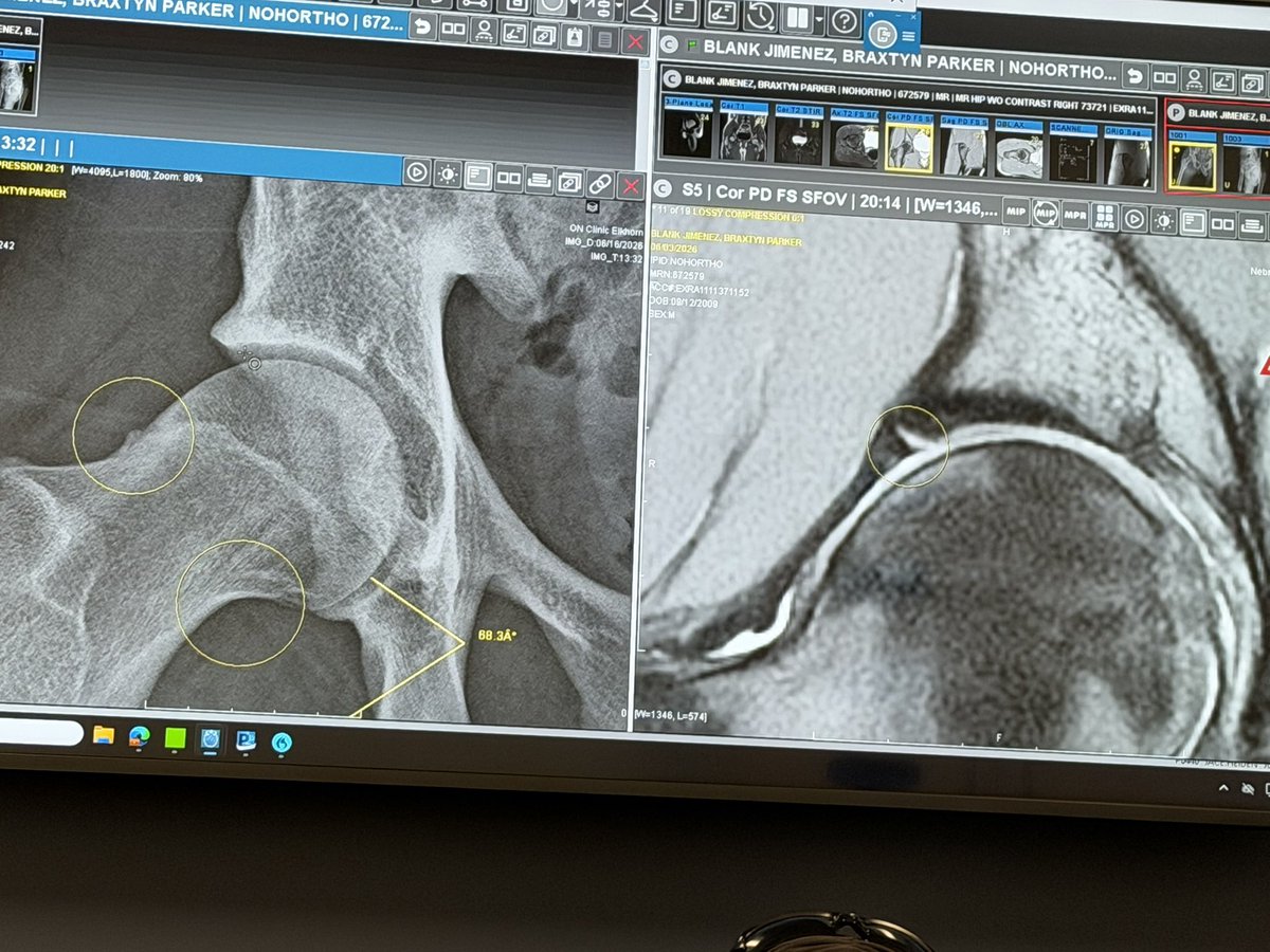 braxtyn44's tweet photo. Didn’t expect to be challenged with illness and a torn hip labrum this spring, but that’s how the season unfolded.

After months of trying to push through it, surgery is next. Grateful to finally have answers and a path forward. https://t.co/3bWlzpWOFn