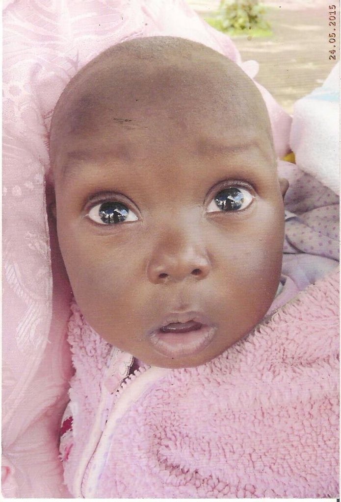 RepentinCHRIST's tweet photo. @Prophet_DrOwuor Anyone remember Simon healed of progeria?

#EndTimeRevivalFire https://t.co/Wsand2IvoD