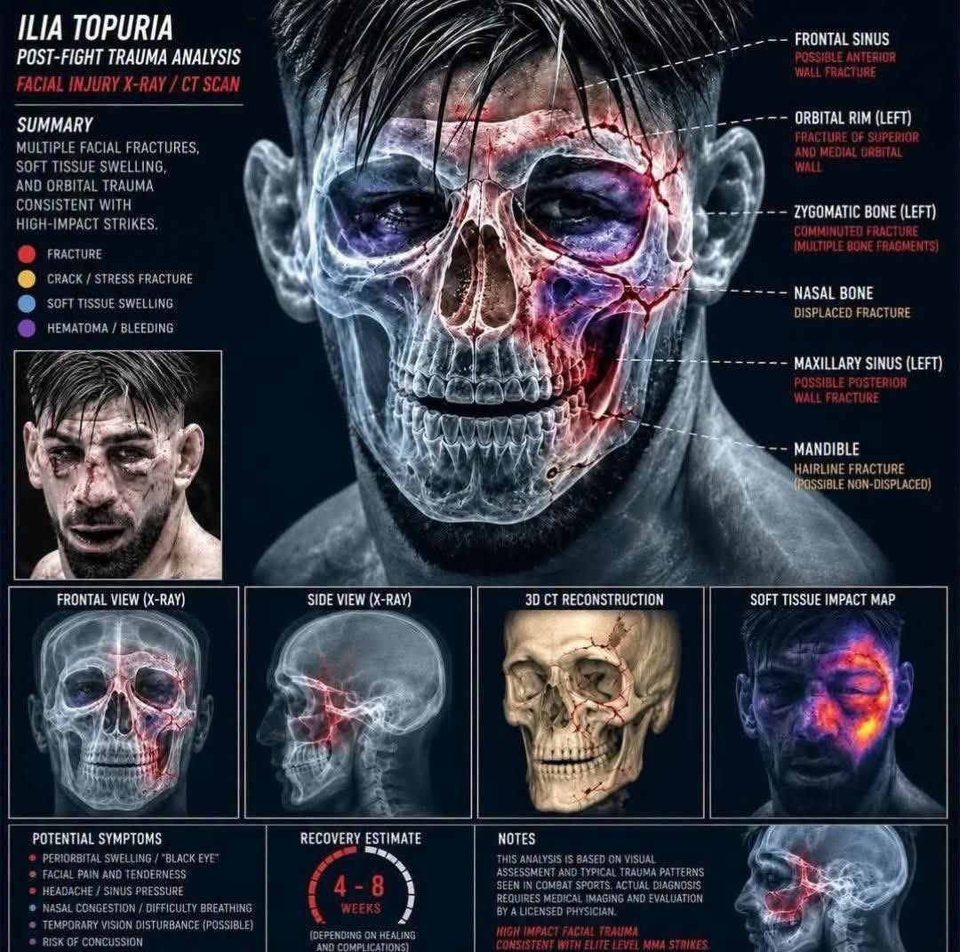 ChickenKingMMA's tweet photo. Justin Gaethje rearranged Ilia’s face https://t.co/56LAEcC3tr
