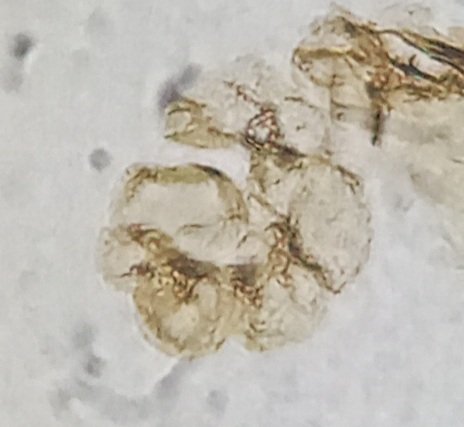 biostratigraphy's tweet photo. Palinoforaminíferos. Son revestimientos orgánicos internos de los foraminíferos. 
Tienen utilidad geológica y científica en Paleoecología y Paleogeografía. 
En la Exploración de Hidrocarburos  se utilizan comúnmente para correlacionar estratos.
#palinología #bioestratigrafía https://t.co/AWa3DO1XnS