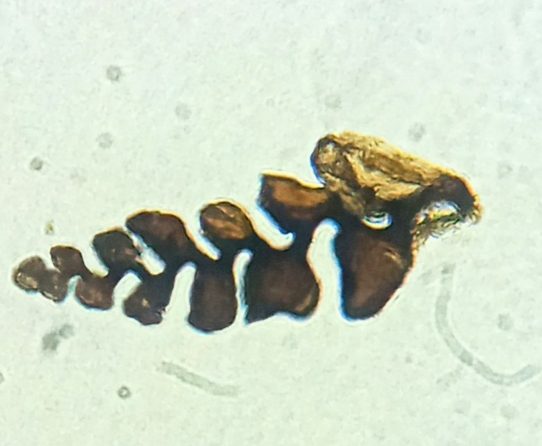 biostratigraphy's tweet photo. Palinoforaminíferos. Son revestimientos orgánicos internos de los foraminíferos. 
Tienen utilidad geológica y científica en Paleoecología y Paleogeografía. 
En la Exploración de Hidrocarburos  se utilizan comúnmente para correlacionar estratos.
#palinología #bioestratigrafía https://t.co/AWa3DO1XnS