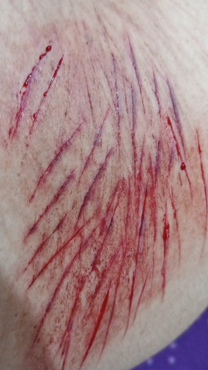kakyoinxd_akko's tweet photo. I feel a little dizzy...
#shtwt #slittwt 
#cuts
#allfake 
Fake makeup! https://t.co/wpvbG8pTdT